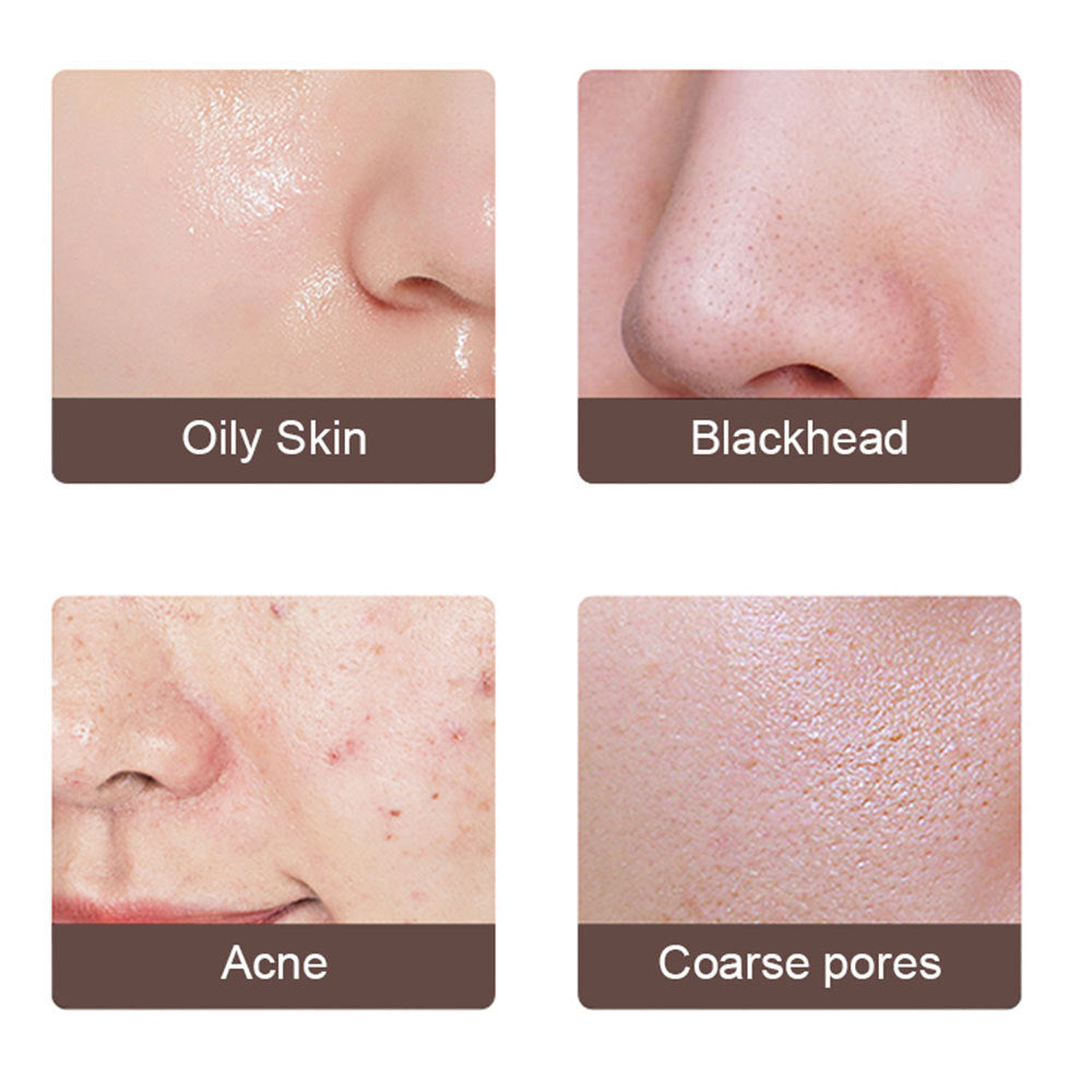NOVYRA™ SilkSmooth™ – Ultrasonic Facial Scrubber & Deep Pore Cleanser